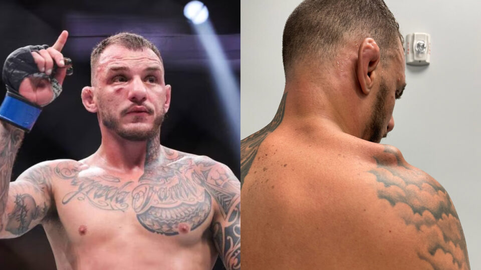 Renato Moicano, gravement blessé avant UFC Paris contre BSD